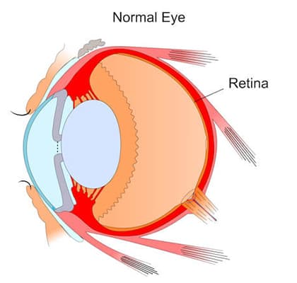 Normal Retina